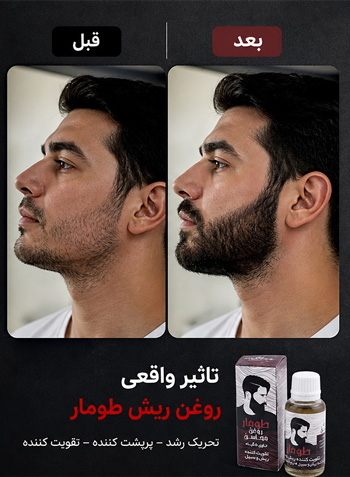 قبل-و-بعد-استفاده-تقویت-ریش-طومار