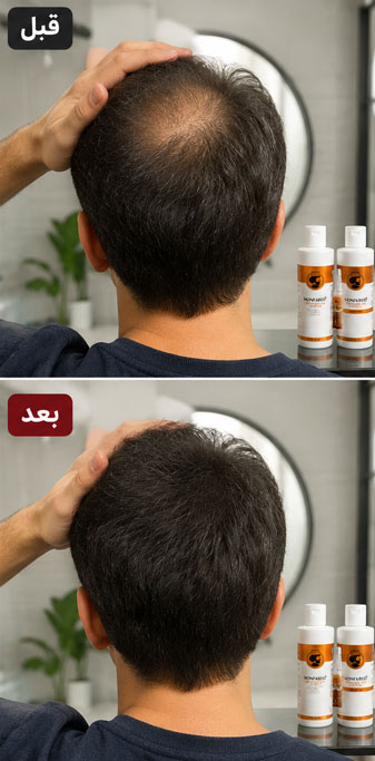 نتایج-استفاده-از-منفرد+
