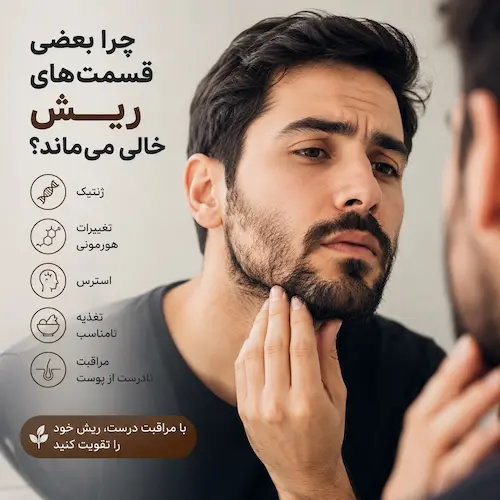 چرا بعضی قسمت_های ریش خالی می_ماند؟